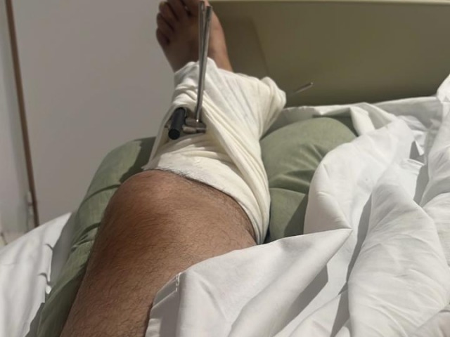 Javier Fras ser operado tras haber sido baleado en un asalto